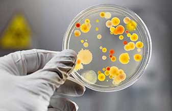 Robert Fabian Crespo Rosas - Foto 1