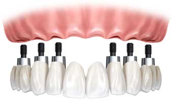 Laboratório Prótese Elias - Foto 1